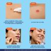 Bioré Paint & Peel Liquid Pimple Patch, Invisible Pimple Patch with Salicylic Acid, Up to 100 Uses, .5 Oz
