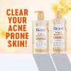 Biore Clear & Breathable Cooling Cleanser with Witch Hazel, Acne Treatment for Face, Face Scrub for Oily Skin, Salicylic Acid Cleanser, 6.77 Oz(Cleanser)